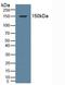 Nuclear Receptor Subfamily 3 Group C Member 2 antibody, LS-C314517, Lifespan Biosciences, Western Blot image 