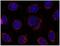 Stromal Interaction Molecule 1 antibody, GTX80195, GeneTex, Immunocytochemistry image 