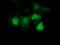 p53 antibody, LS-C786109, Lifespan Biosciences, Immunofluorescence image 