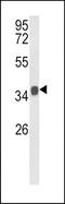 Kruppel Like Factor 6 antibody, TA324852, Origene, Western Blot image 