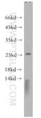 Casein Kinase 2 Beta antibody, 20234-1-AP, Proteintech Group, Western Blot image 