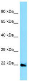 Ephrin A5 antibody, TA338261, Origene, Western Blot image 