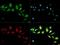 ATP Binding Cassette Subfamily F Member 2 antibody, GTX30469, GeneTex, Immunocytochemistry image 