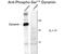 Dynamin 1 antibody, GTX82703, GeneTex, Western Blot image 