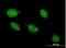 Angiopoietin-related protein 7 antibody, H00010218-M05-100ug, Novus Biologicals, Immunofluorescence image 