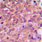 Protein Kinase AMP-Activated Non-Catalytic Subunit Beta 1 antibody, LS-C354056, Lifespan Biosciences, Immunohistochemistry paraffin image 