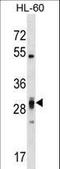 Pleckstrin Homology And FYVE Domain Containing 2 antibody, LS-C163788, Lifespan Biosciences, Western Blot image 