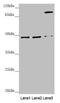 Secernin 2 antibody, LS-C676463, Lifespan Biosciences, Western Blot image 