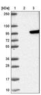 Sulfotransferase Family 1C Member 2 antibody, NBP1-80711, Novus Biologicals, Western Blot image 