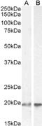 Ubiquitin Conjugating Enzyme E2 C antibody, LS-C55643, Lifespan Biosciences, Western Blot image 