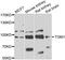 Transglutaminase 1 antibody, A02484, Boster Biological Technology, Western Blot image 