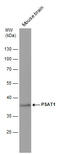 Psat antibody, GTX633623, GeneTex, Western Blot image 