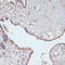 CD47 Molecule antibody, 18-341, ProSci, Immunohistochemistry paraffin image 