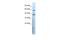 Cholinergic Receptor Nicotinic Delta Subunit antibody, A01834, Boster Biological Technology, Western Blot image 