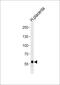 DAB Adaptor Protein 2 antibody, PA5-72609, Invitrogen Antibodies, Western Blot image 