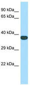 Transmembrane Protein 165 antibody, TA331044, Origene, Western Blot image 