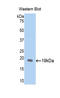 Lysyl Oxidase Like 1 antibody, LS-C299995, Lifespan Biosciences, Western Blot image 