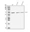 Glutamate Decarboxylase 1 antibody, PB9183, Boster Biological Technology, Western Blot image 