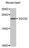 Suppressor Of Cytokine Signaling 2 antibody, STJ27670, St John