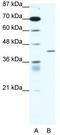 Peroxisome Proliferator Activated Receptor Delta antibody, TA332042, Origene, Western Blot image 