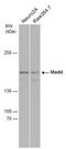 MAP kinase-activating death domain protein antibody, GTX130249, GeneTex, Western Blot image 