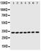 Enoyl-CoA Delta Isomerase 1 antibody, PA5-79184, Invitrogen Antibodies, Western Blot image 