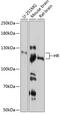 HR Lysine Demethylase And Nuclear Receptor Corepressor antibody, 14-220, ProSci, Western Blot image 