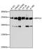 Myosin Heavy Chain 14 antibody, GTX66014, GeneTex, Western Blot image 
