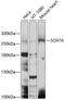 Sodium Voltage-Gated Channel Alpha Subunit 7 antibody, 13-423, ProSci, Western Blot image 