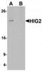 HIG1 Hypoxia Inducible Domain Family Member 2A antibody, TA320133, Origene, Western Blot image 