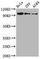 Forkhead Box O3 antibody, CSB-RA008836A253phHU, Cusabio, Western Blot image 