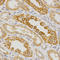 Interleukin-23 receptor antibody, LS-C331585, Lifespan Biosciences, Immunohistochemistry paraffin image 