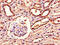 Acylglycerol Kinase antibody, CSB-PA706634LA01HU, Cusabio, Immunohistochemistry paraffin image 