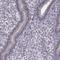 Chromosome 10 Open Reading Frame 62 antibody, HPA072947, Atlas Antibodies, Immunohistochemistry frozen image 