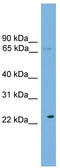 Calcium Binding And Coiled-Coil Domain 1 antibody, TA344754, Origene, Western Blot image 