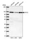 Kinesin Family Member C3 antibody, PA5-54359, Invitrogen Antibodies, Western Blot image 