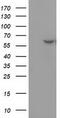 Dystrobrevin Alpha antibody, CF502164, Origene, Western Blot image 