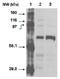 Cytochrome P450 Family 4 Subfamily F Member 11 antibody, orb109155, Biorbyt, Western Blot image 