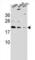 ADP Ribosylation Factor Like GTPase 6 Interacting Protein 6 antibody, abx027353, Abbexa, Western Blot image 