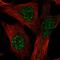 Transmembrane Protein 179B antibody, HPA062068, Atlas Antibodies, Immunofluorescence image 