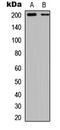 TSC Complex Subunit 2 antibody, LS-C358381, Lifespan Biosciences, Western Blot image 