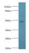 Protein arginine N-methyltransferase 2 antibody, MBS1496545, MyBioSource, Western Blot image 