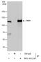 Staphylococcal Nuclease And Tudor Domain Containing 1 antibody, PA5-40124, Invitrogen Antibodies, Immunoprecipitation image 