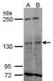 Tyrosine Kinase 2 antibody, PA5-21529, Invitrogen Antibodies, Western Blot image 