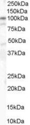 Catenin Alpha 1 antibody, PA5-18512, Invitrogen Antibodies, Western Blot image 