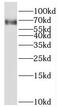 Transcription Factor EC antibody, FNab08628, FineTest, Western Blot image 