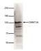 DNA Methyltransferase 3 Alpha antibody, CI1104, Boster Biological Technology, Western Blot image 