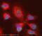 S100 Calcium Binding Protein A9 antibody, ab63818, Abcam, Immunofluorescence image 