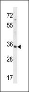 RFNG O-Fucosylpeptide 3-Beta-N-Acetylglucosaminyltransferase antibody, LS-C162553, Lifespan Biosciences, Western Blot image 