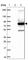 ACOX2 antibody, HPA038280, Atlas Antibodies, Western Blot image 